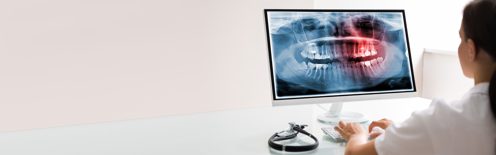 FDA Approves Dental Technology Capable of Reading and Interpreting X-rays