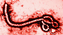 Ebola: Questions, answers, and precautions to take as a dentist