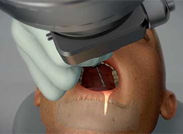 Robotic dentistry is on its way