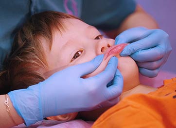 The Special Needs of Special Needs Dental Patients