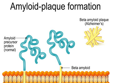 Amyloid-plaque formation