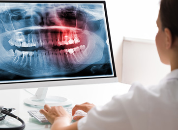 FDA Approves Dental Technology Capable of Reading and Interpreting X-rays