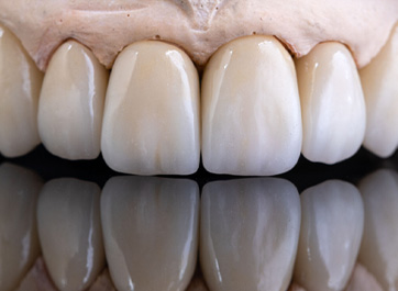 Zirconia Crowns: The Good and the Bad from Dr. Raymond L. Bertolotti, DDS, PhD