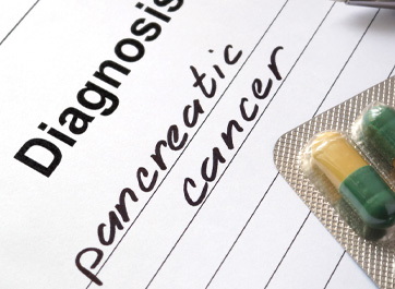 Unlocking Mysteries: Is the Oral Microbiome Linked to Pancreatic Cancer?