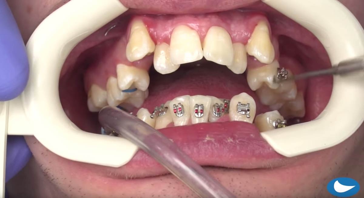 A still shot from The Look Orthodontics video that has more than 12 million views.