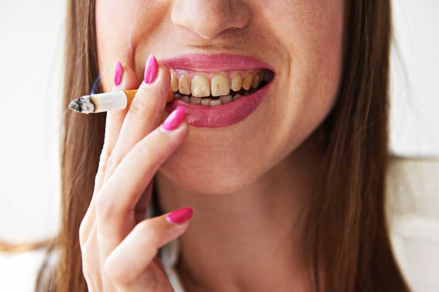 further evidence of the damage that smoking causes to oral health