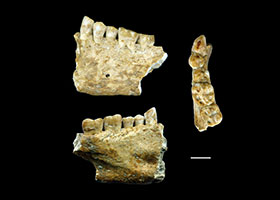 Archaeologists find Earliest Evidence of Dental Fillings