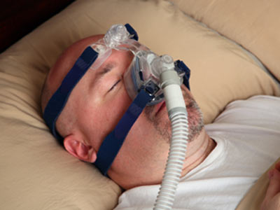 Manage Mallampati Class IV sleep apnea patient with utmost care